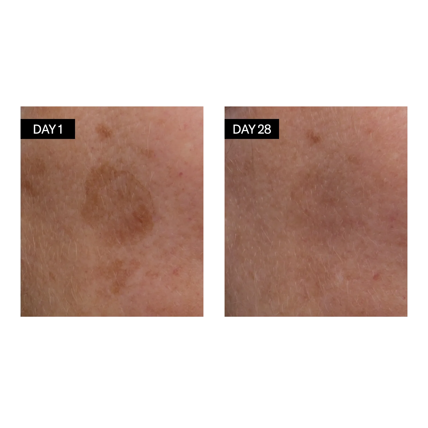 Brightening Serum  • Vitamin C & E   Hyaluronic Acid